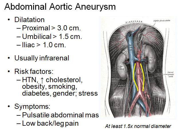 Chapter 5 : Prevertebral Vessels: Abnormal