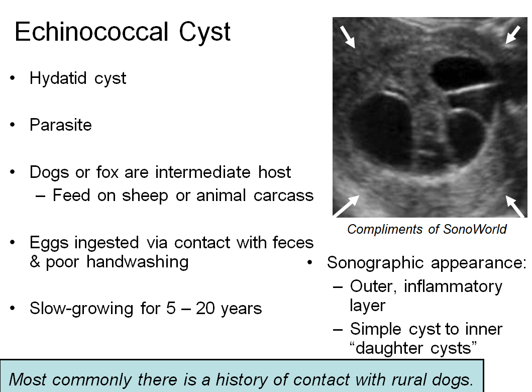 Chapter 3 : Liver: Abnormal