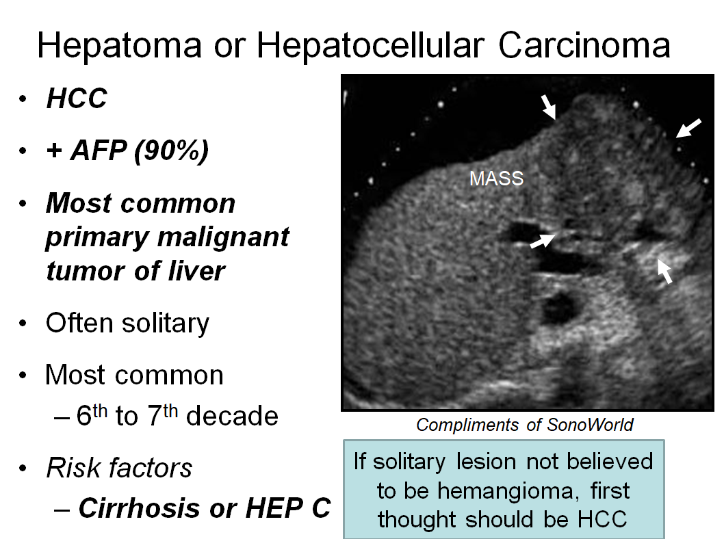 Chapter 3 : Liver: Abnormal