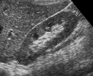 Chapter 10: Urinary System and Adrenal Glands: Normal