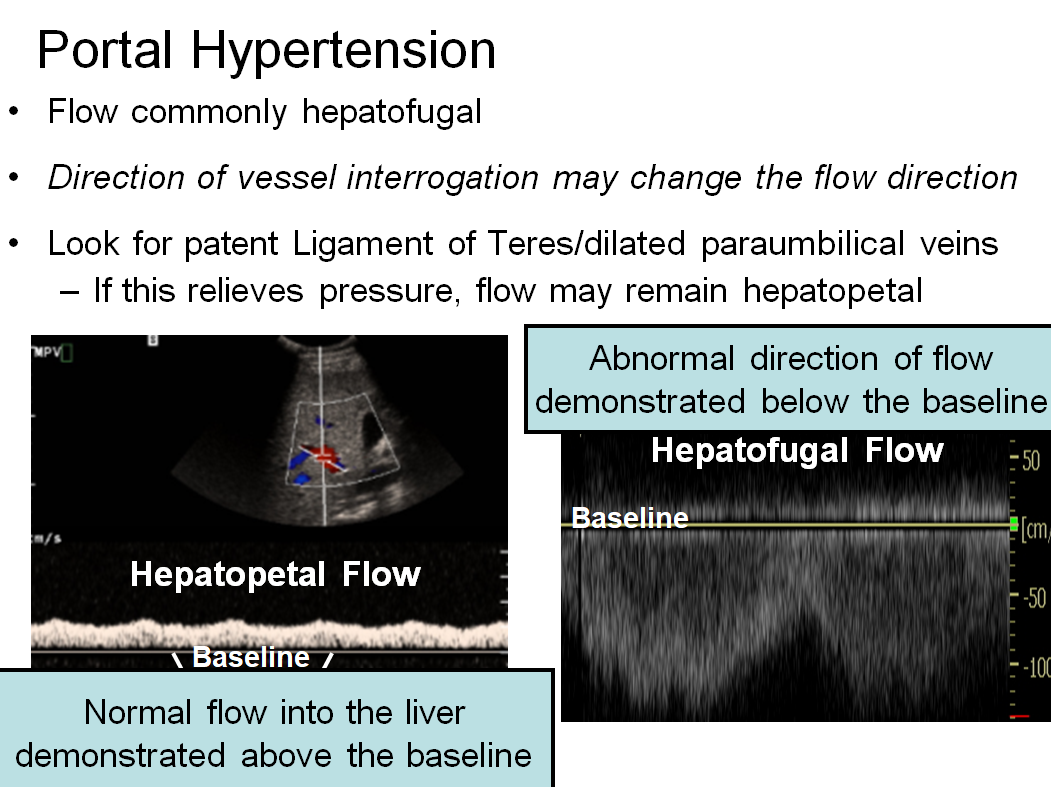 Chapter 3 : Liver: Abnormal