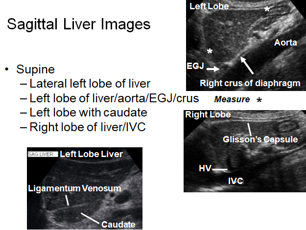 Chapter 2 : Liver: Normal