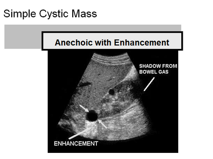Chapter 1 : Introduction to Ultrasound
