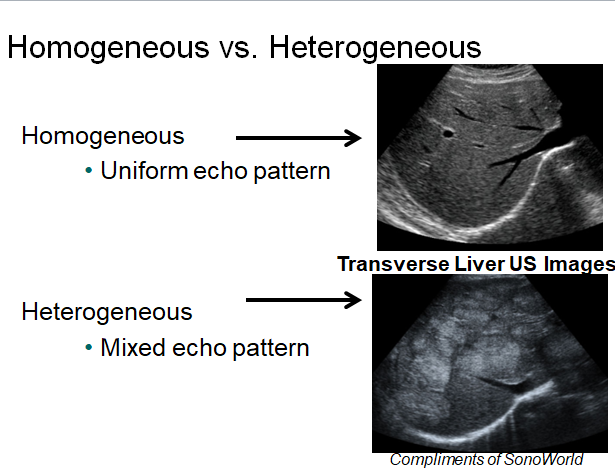 Chapter 1 : Introduction to Ultrasound