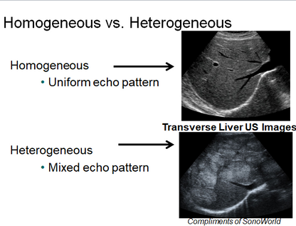Chapter 1 : Introduction to Ultrasound