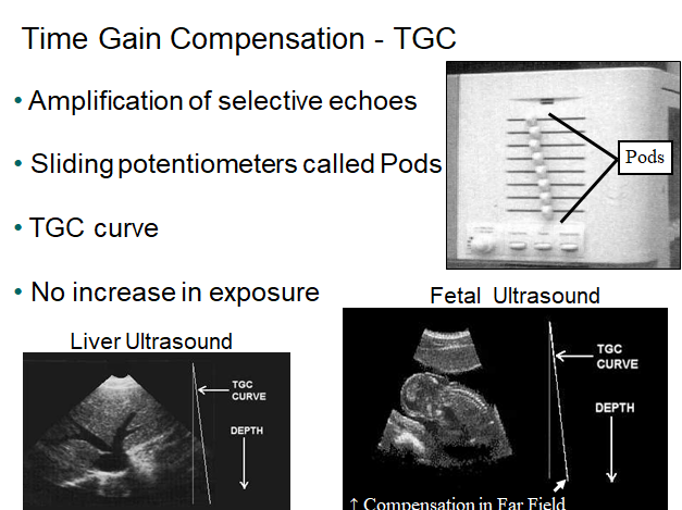 Chapter 1 : Introduction to Ultrasound