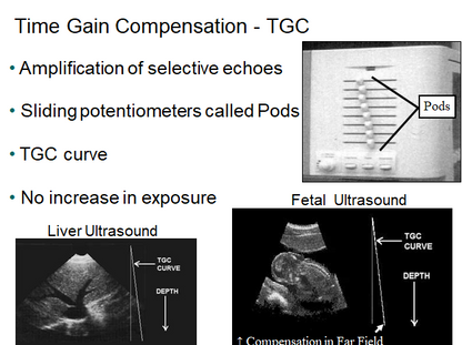 Chapter 1 : Introduction to Ultrasound