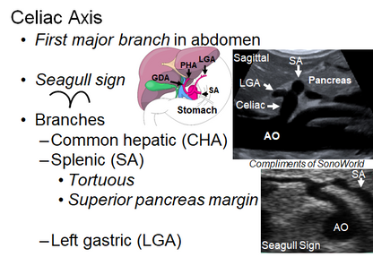 Chapter 4 : Prevertebral Vessels: Normal