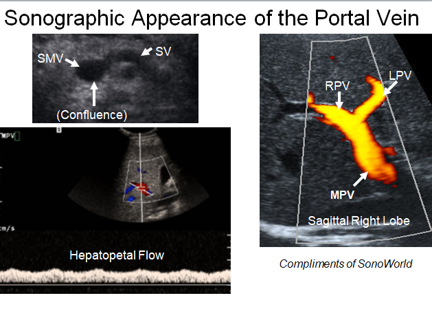 Chapter 4 : Prevertebral Vessels: Normal