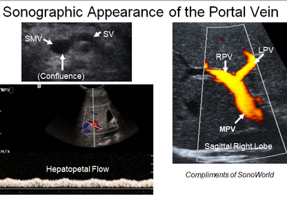 Chapter 4 : Prevertebral Vessels: Normal