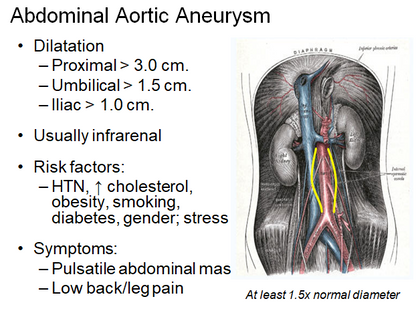 Chapter 5 : Prevertebral Vessels: Abnormal