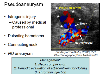 Chapter 5 : Prevertebral Vessels: Abnormal