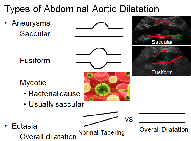 Chapter 5 : Prevertebral Vessels: Abnormal