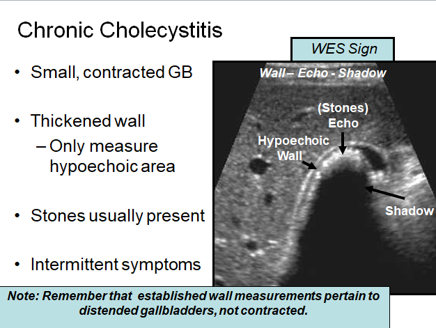 Chapter 7 : Biliary System: Abnormal