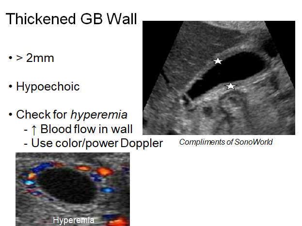 Chapter 7 : Biliary System: Abnormal