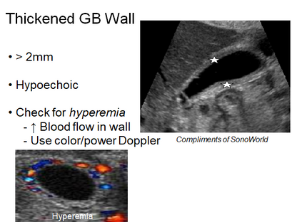 Chapter 7 : Biliary System: Abnormal