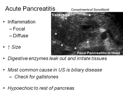 Chapter 9 : Pancreas: Abnormal