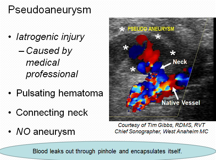 Chapter 12: Abdominal Vascular Sonography