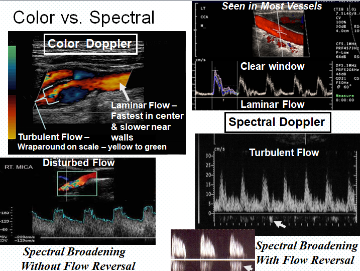 Chapter 12: Abdominal Vascular Sonography