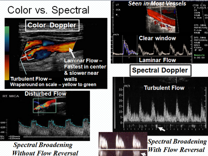Chapter 12: Abdominal Vascular Sonography
