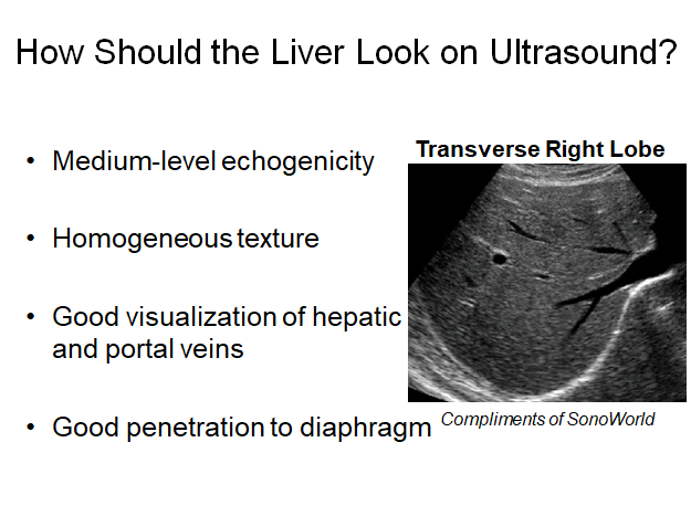Chapter 2 : Liver: Normal