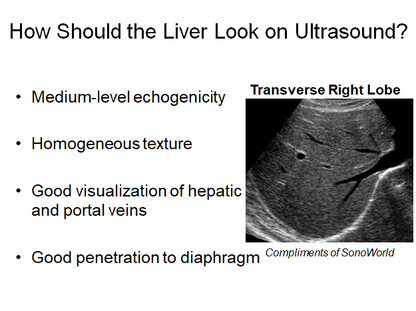 Chapter 2 : Liver: Normal