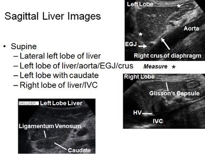 Chapter 2 : Liver: Normal