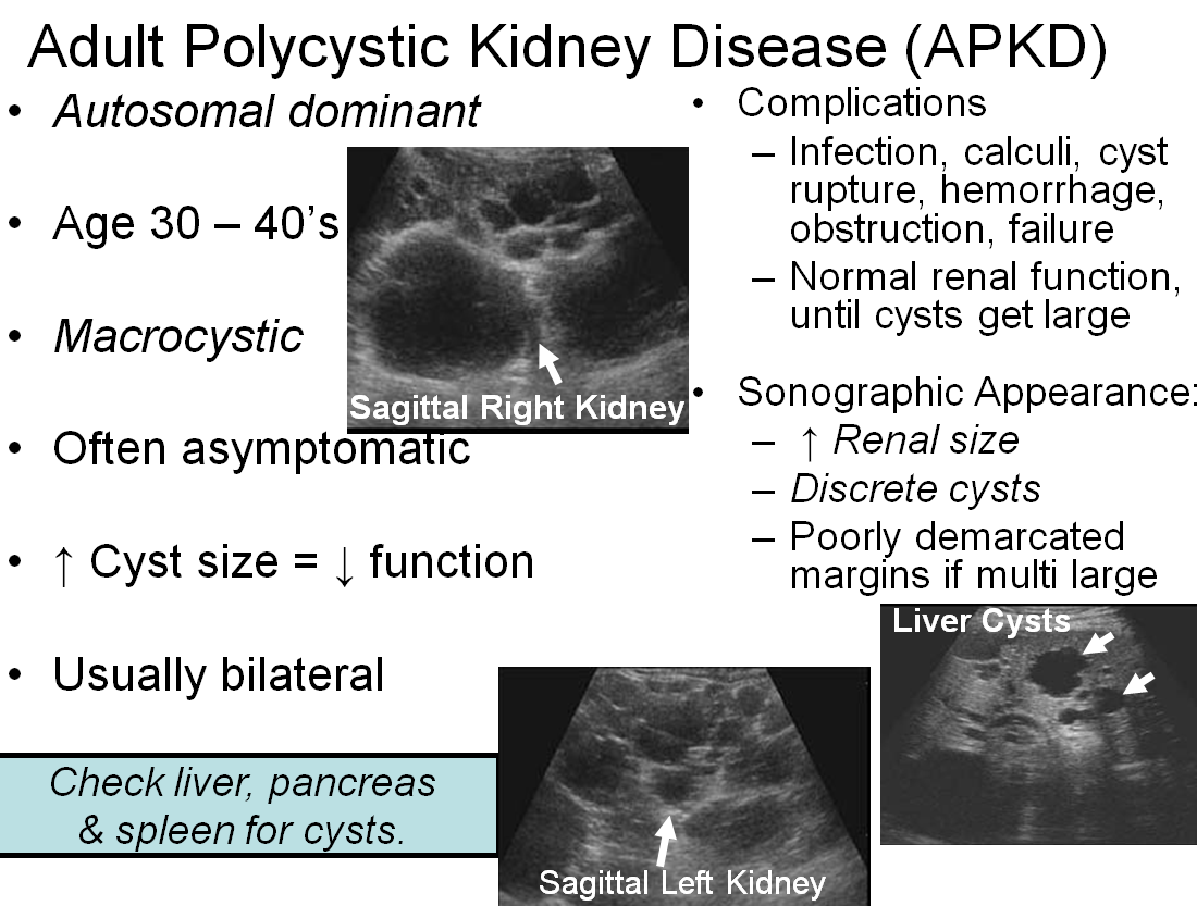 Chapter 11: Urinary System and Adrenal Glands: Abnormal